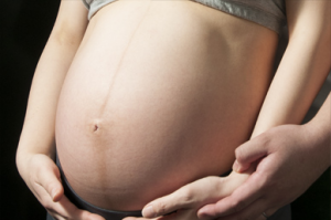 妊娠線には正中線というものもあります。ベルタの妊娠線クリームは正中線にも効果的です