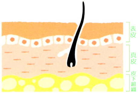 妊娠線の仕組み、正常な皮膚の断面図