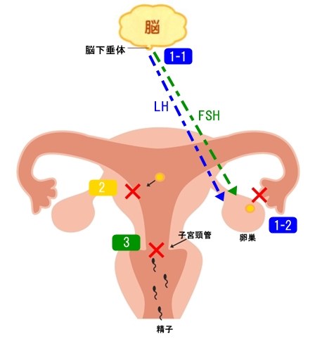 ピルは避妊効果を2重3重の作用で発揮します